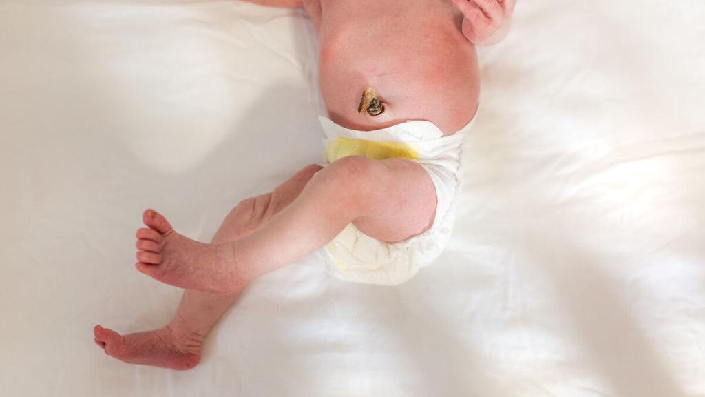 What to Know About Baby's Umbilical Cord Falling Off Peanut