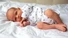 Newborn Dry Skin: What to Know and What to Do